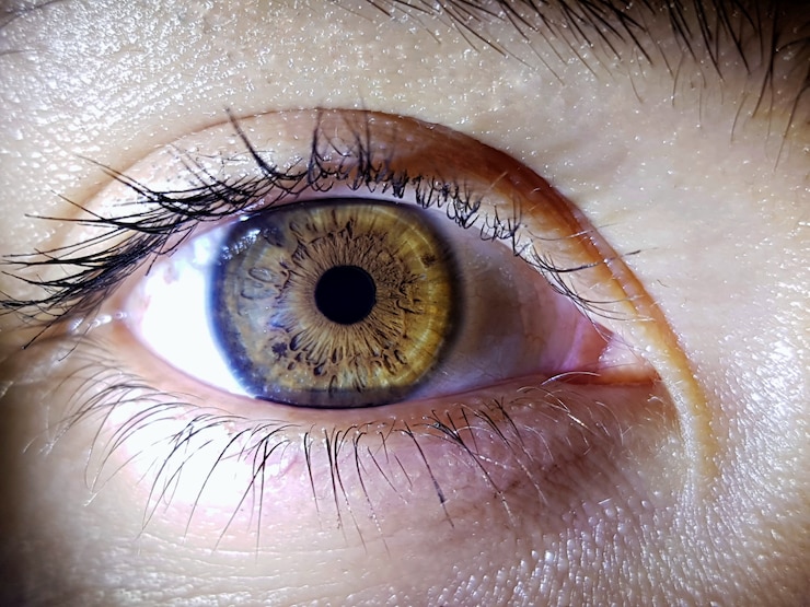 <strong>5 Common Eye Problems</strong>